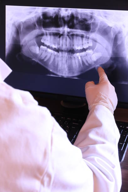 Best Emergency Tooth Extraction in Horace, ND